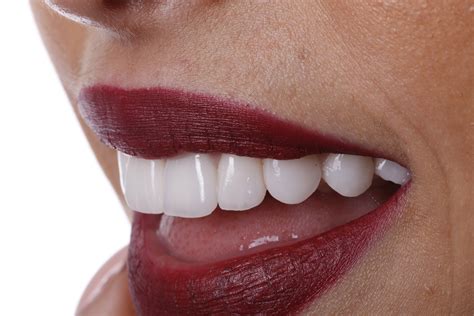 Transform your teeth with the power of natural tooth brightening techniques